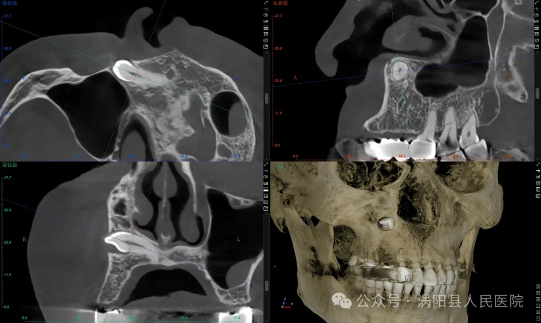 640 (1)_看图王002.jpg